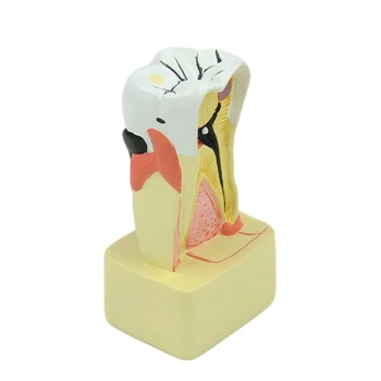 Periodontální Model PVC Zubní Patologie Zubů Model pro Zubaře Výuky Dropship