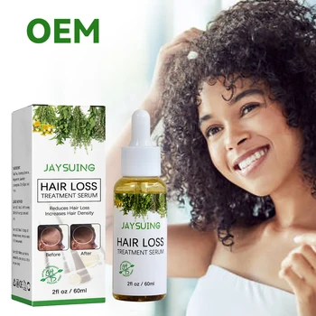 Rozmarýn Zázvor Olej Vlasy Růst Rychlý Produktu Léčbu Vypadávání Vlasů Opětovný Růst Vlasů Pro Muže, Ženy, Preventivní Veganic Přírodní Sérum